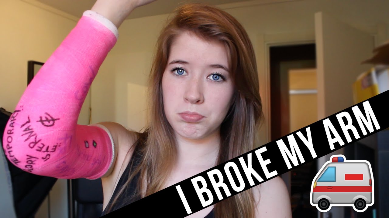 I BROKE MY ARM!