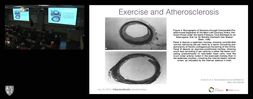 Heart Disease Prevention: What You Really Need to Know About Diet, Exercise, and Heart Health