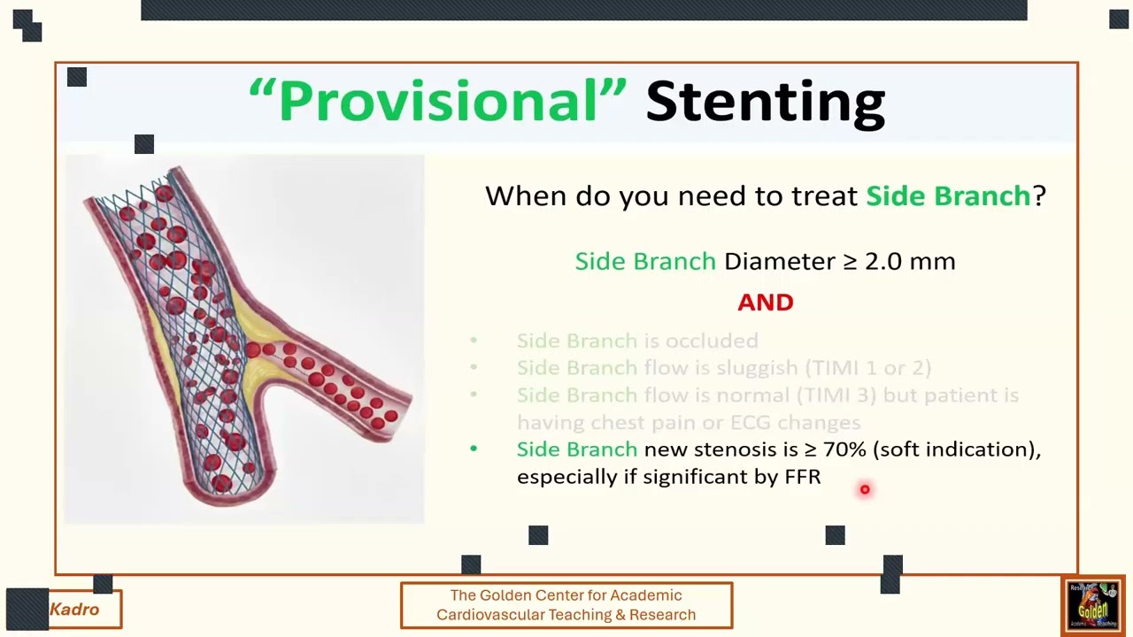 فن التداخلات على مناطق التفرع في الشرايين الاكليلية.  The Arts of Bifurcation Interventions 