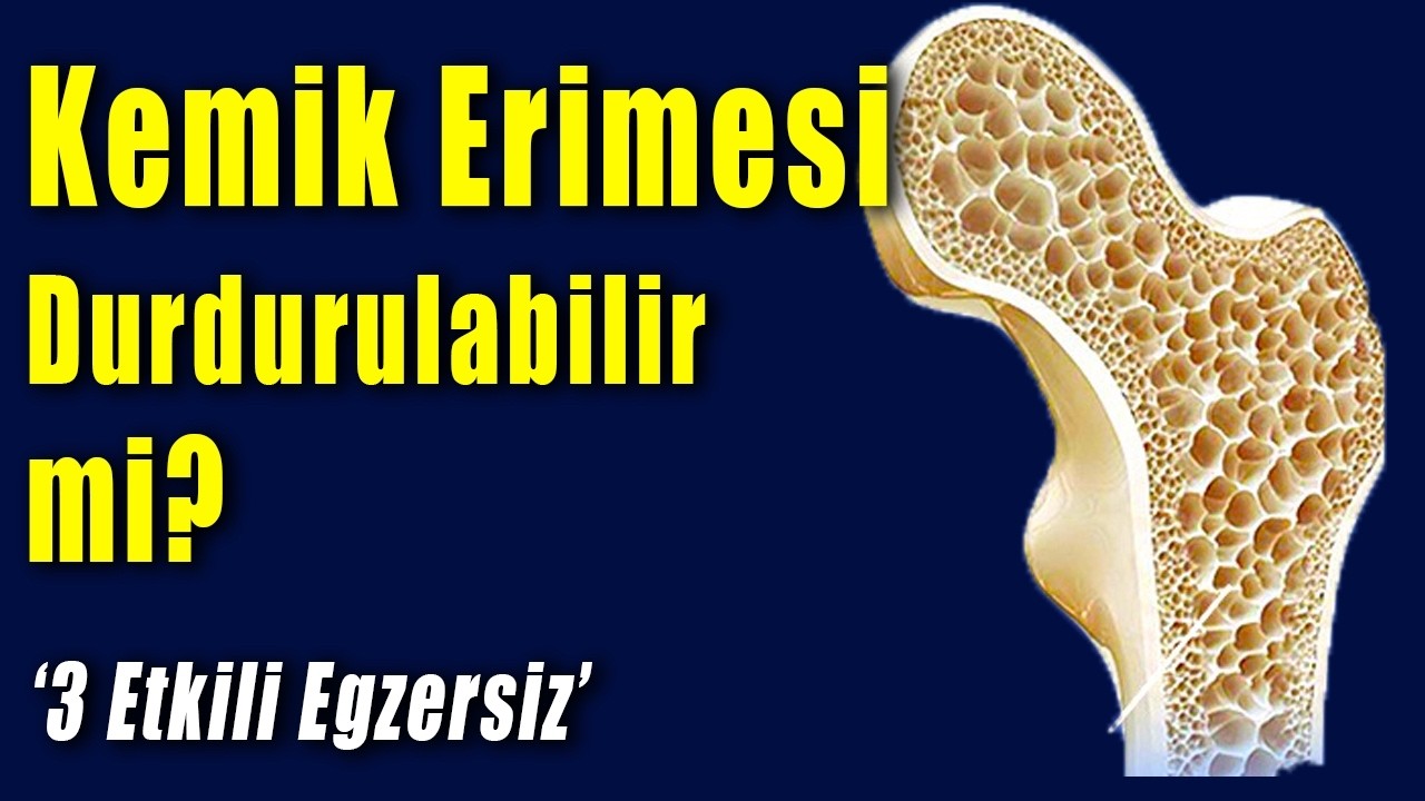 Kemik Erimesi Durdurulabilir mi? 3 Etkili Egzersiz #aktifizyo