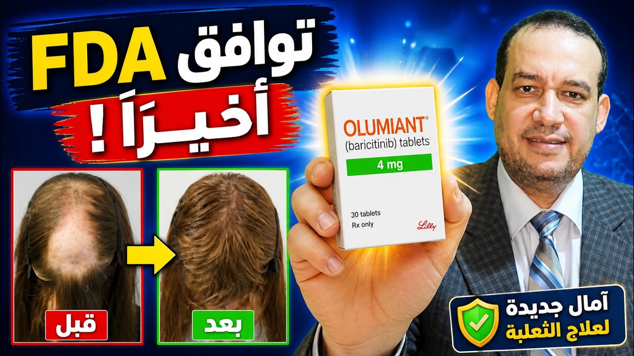 أحدث دواء لعلاج الثعلبه و تساقط الشعر الشديد