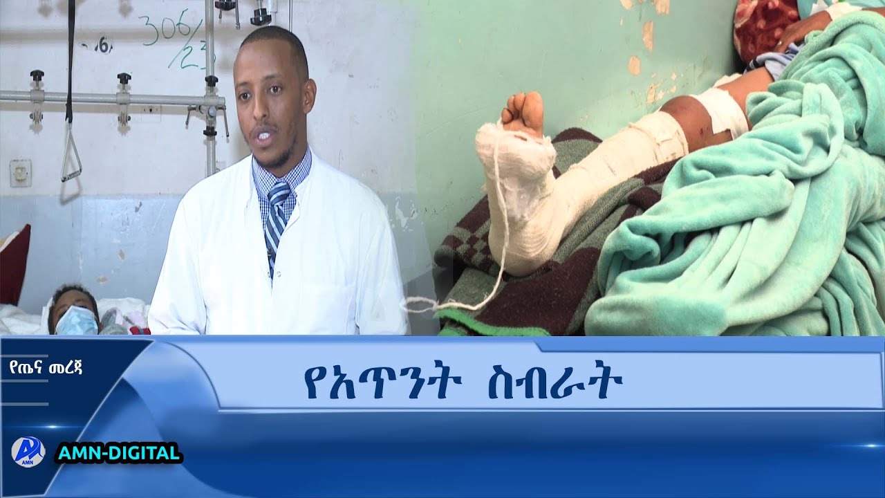 የጤና መረጃ|  የአጥንት ስብራት