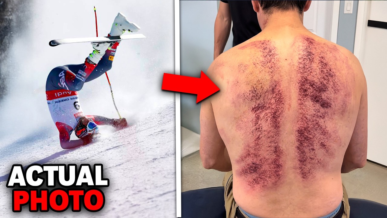 5 NAJGORSZYCH ŚMIERCI W SPORTACH ZIMOWYCH W HISTORII TELEWIZJI