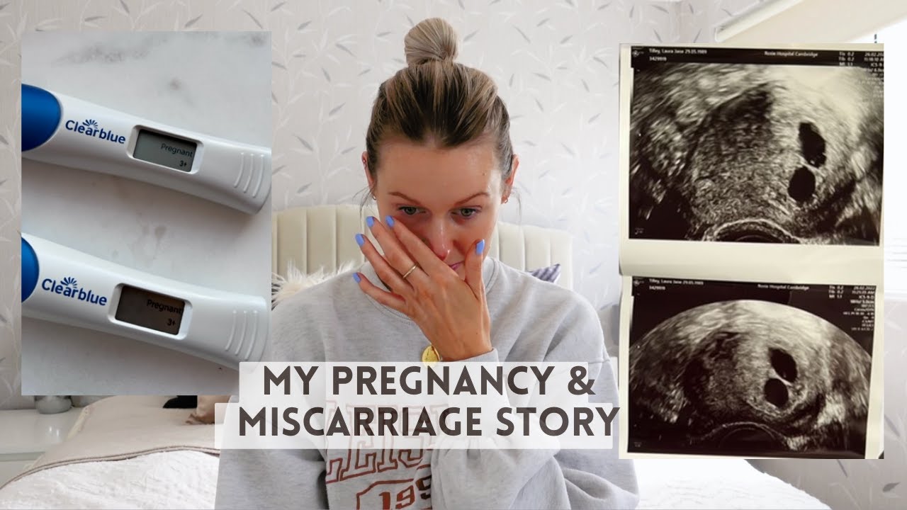 *TRIGGER WARNING* MY MISSED MISCARRIAGE STORY - Losing my twin pregnancy at 10 weeks