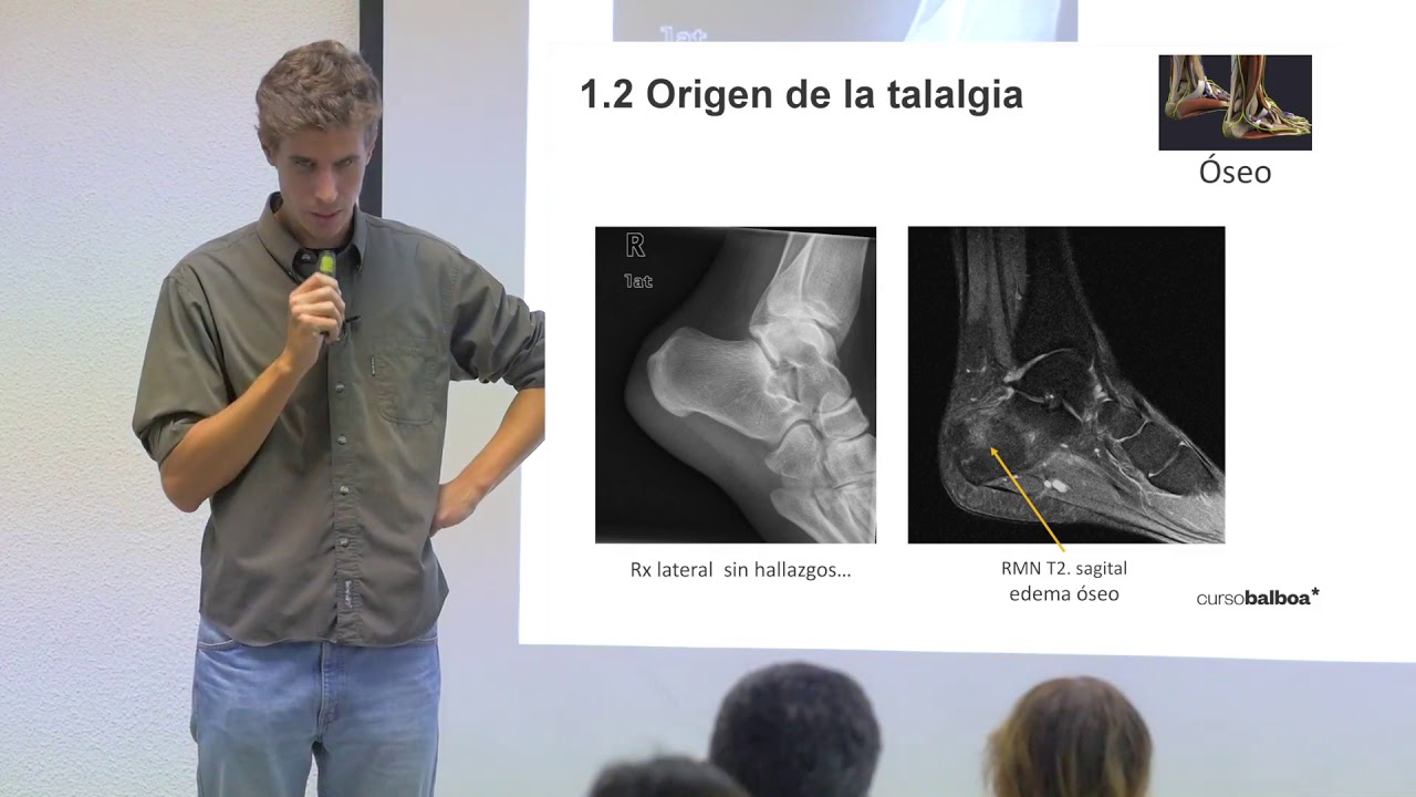 Diagnóstico Diferencial de la talalgia. ¿Qué puede ser si no es la fascia plantar?: parte 1