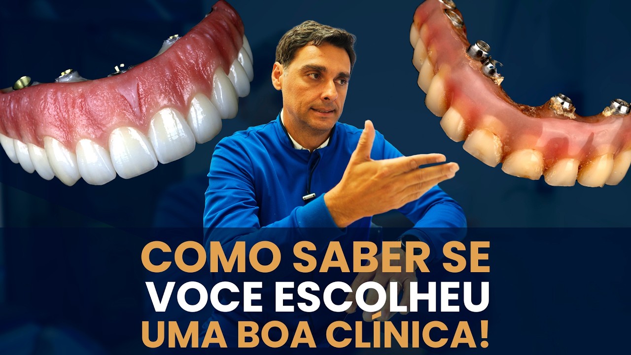 Protocolo All on 4 em 3 Dias é Mentira? - Como Saber Se Não Vou Comprar Gato Por Lebre