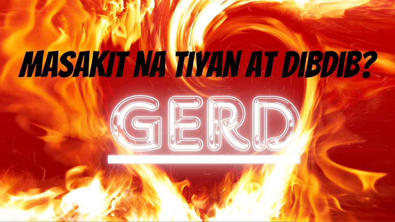 Iwasan ang Sakit Dahil sa Esophageal Reflux: PAANO?