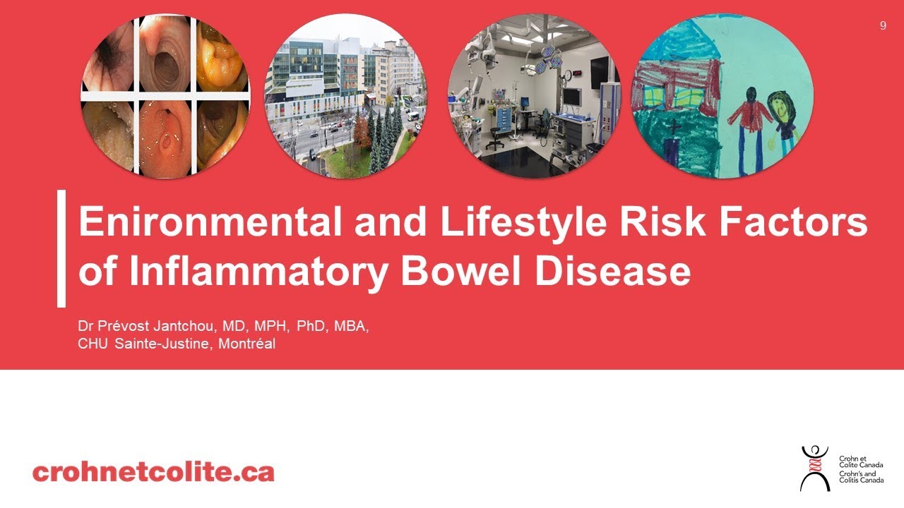 Environmental and Lifestyle Risk Factors of Inflammatory Bowel Disease