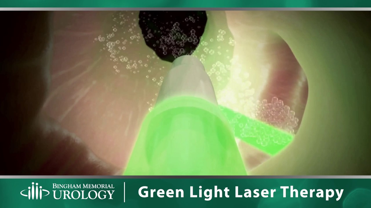BMH Green Light Overview