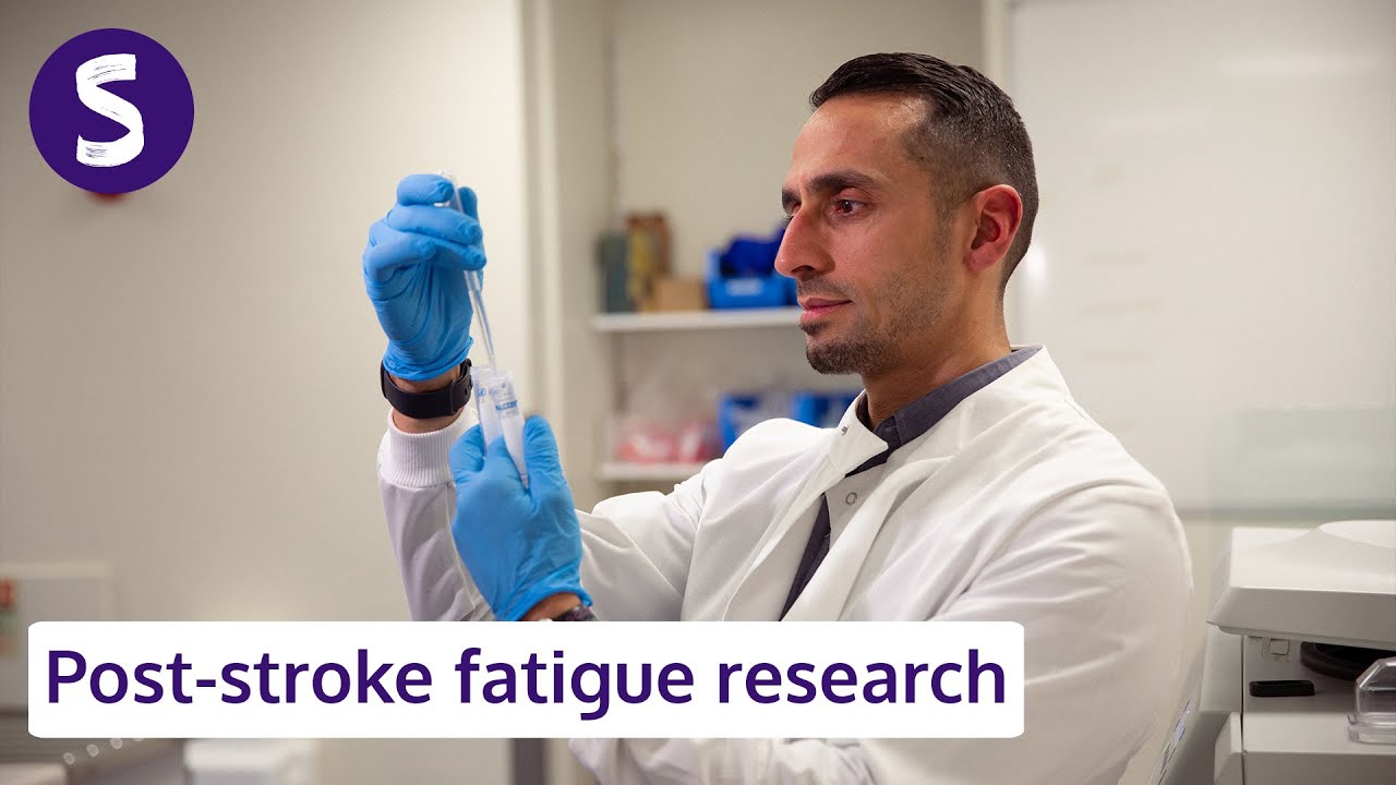 How stroke research could impact post stroke fatigue