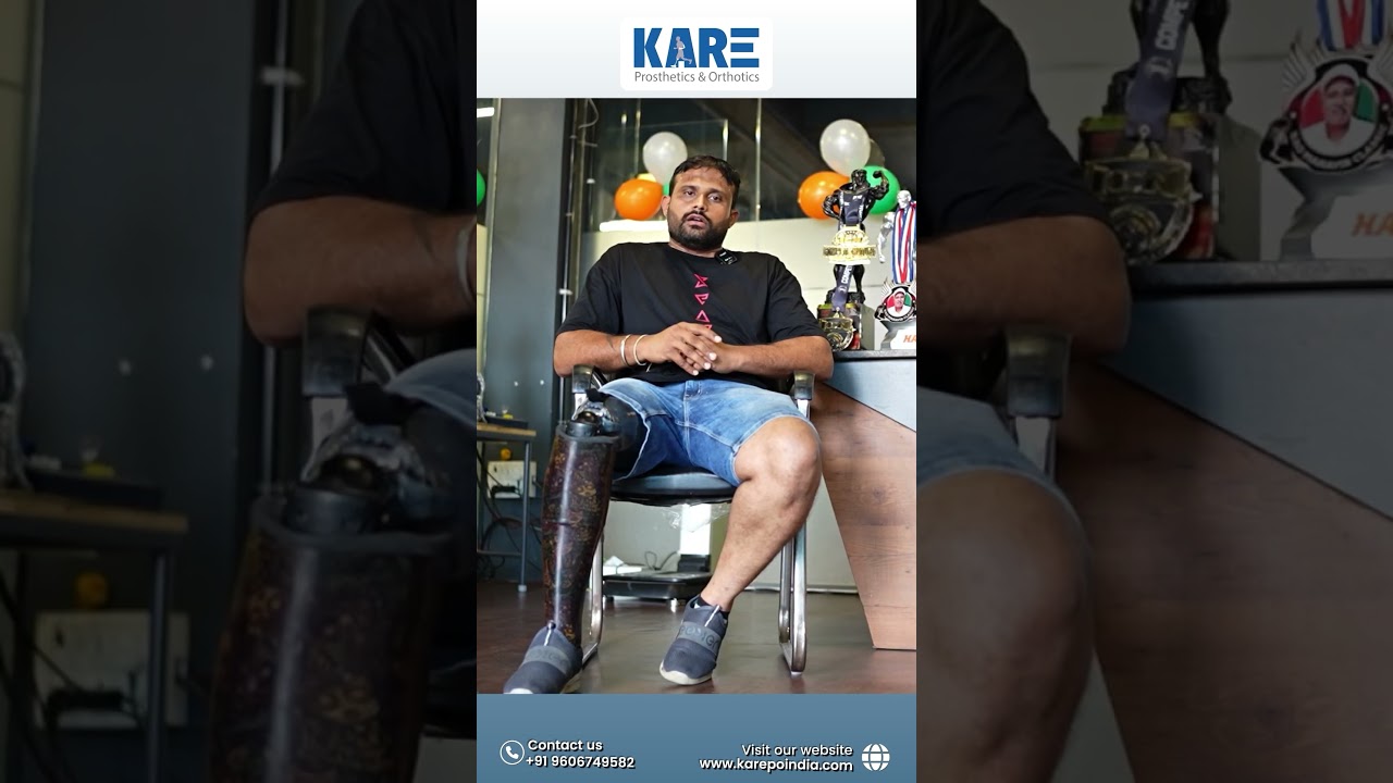 Expert Prosthetic Services, From Fitting to Function at KARE!🦿