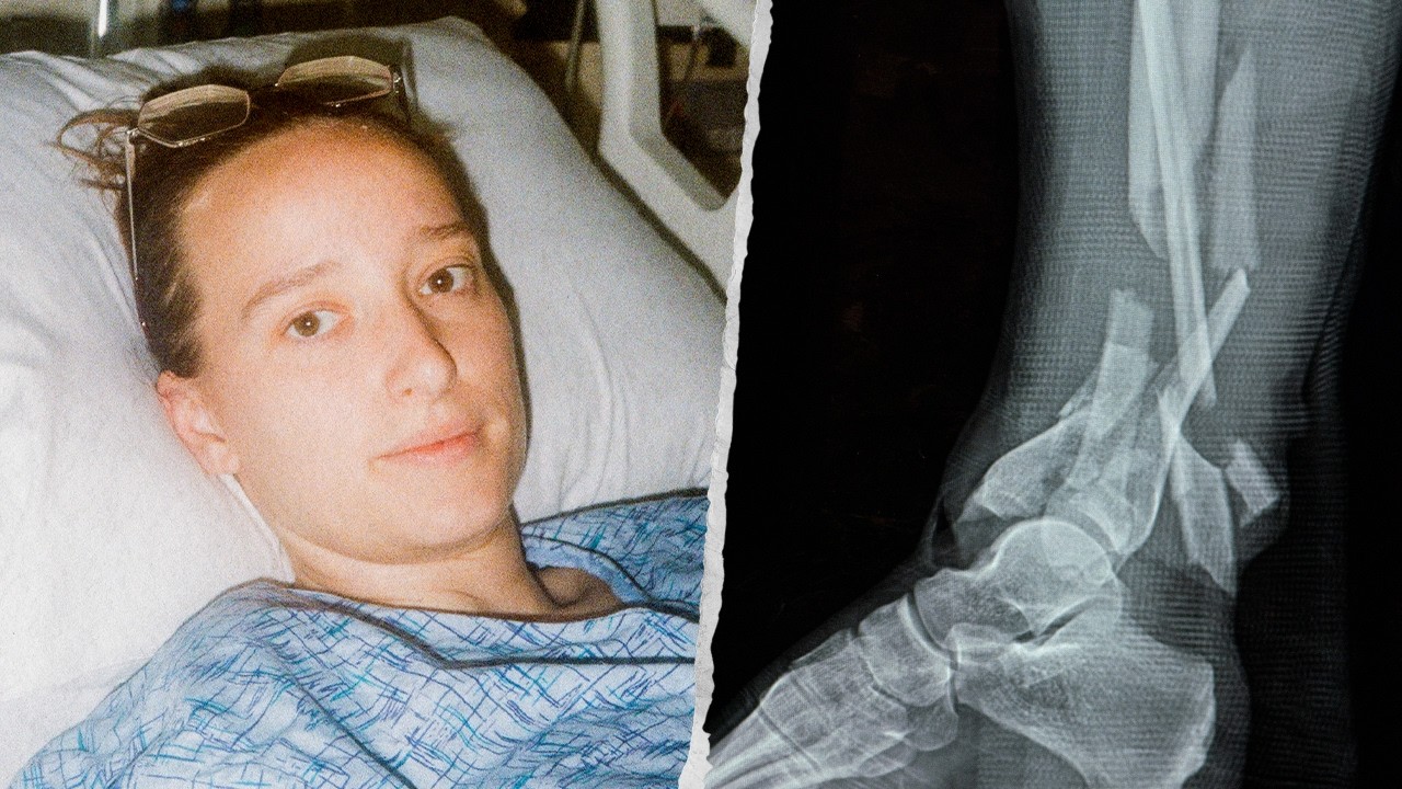 I Nearly Lost My Leg In a Rock Climbing Accident