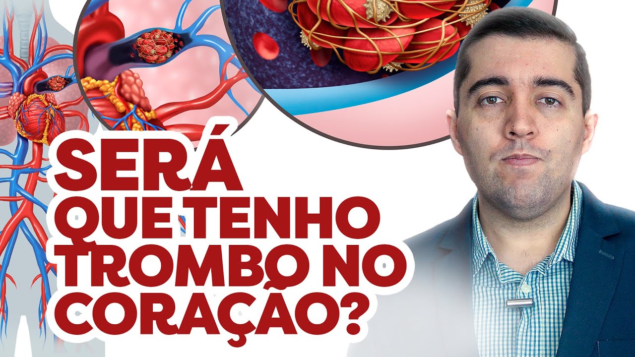Trombo no coração: como desfazer coágulos e qual risco de embolia, AVC, infarto e amputação na perna