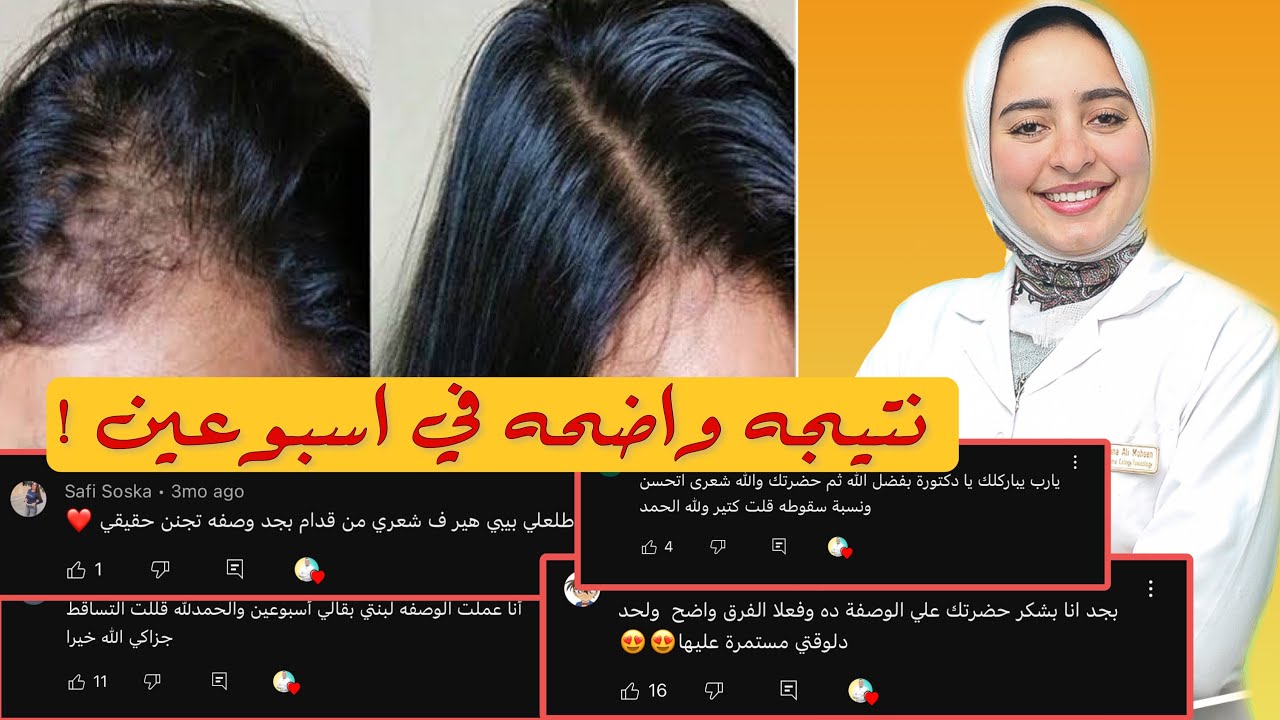 الوصفه الوحيده المثبته علميا والمجربه لايقاف التساقط وانبات الفراغات وتطويل الشعر في اسبوعين