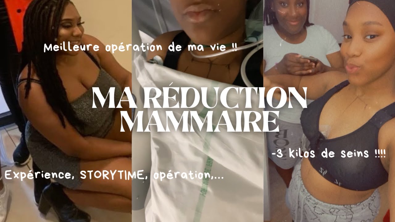 MA RÉDUCTION MAMMAIRE (expérience, story Time, opération, douleurs,…)