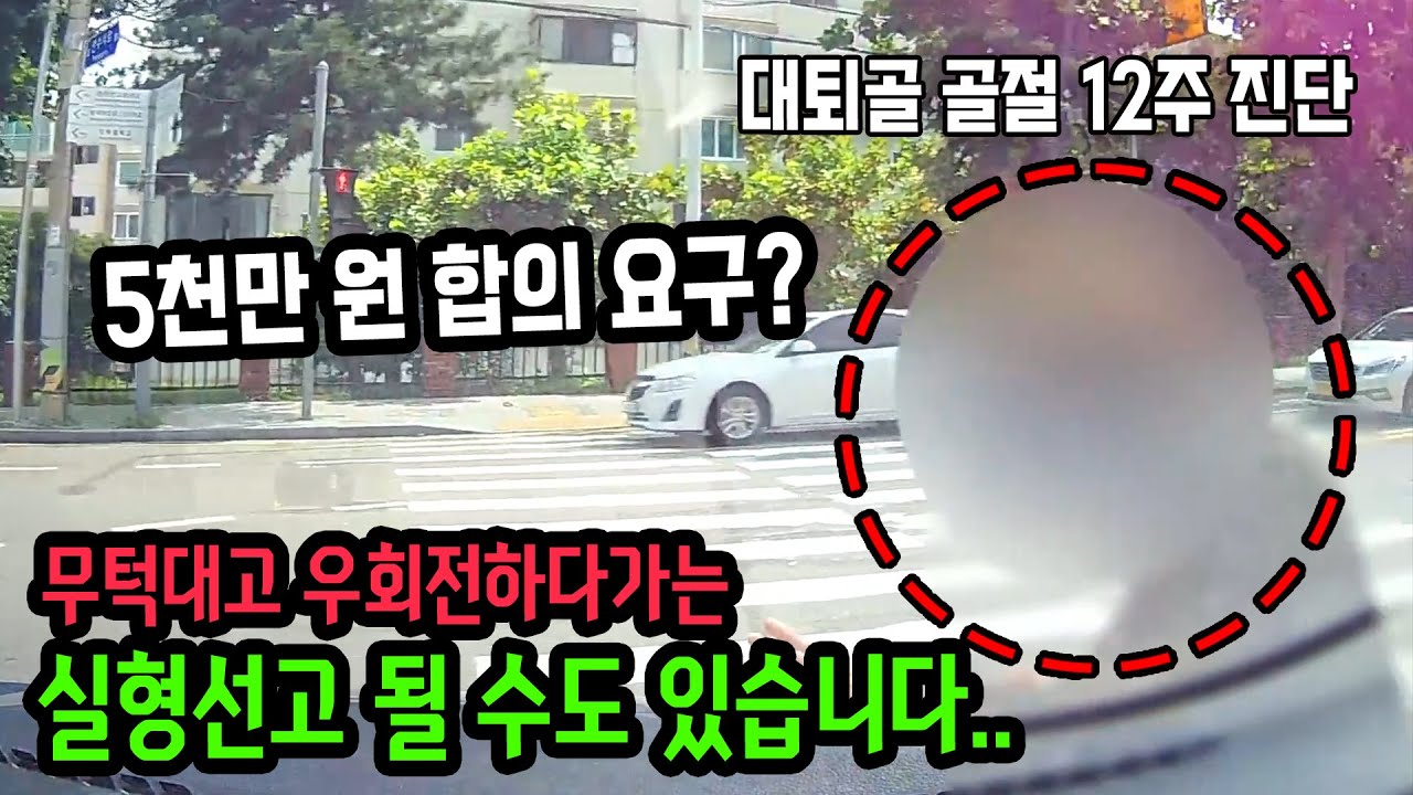 15883회. 형사합의금으로 5천만 원 달라해서 합의를 못 하고 있었습니다. 그런데 아무것도 안하고 판결선고 받으면 큰일 날 뻔 했습니다..