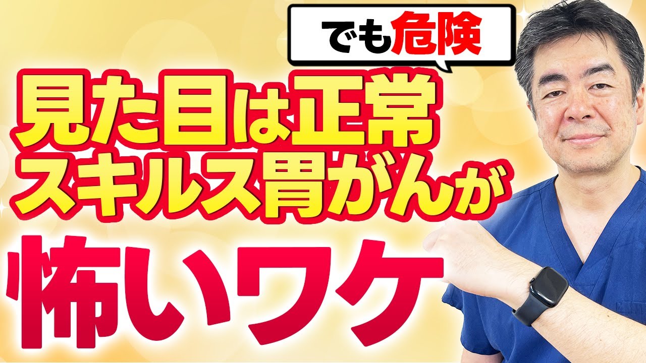 【早期発見必須】見逃されやすいスキルス胃がんがなぜ怖いのかを徹底解説