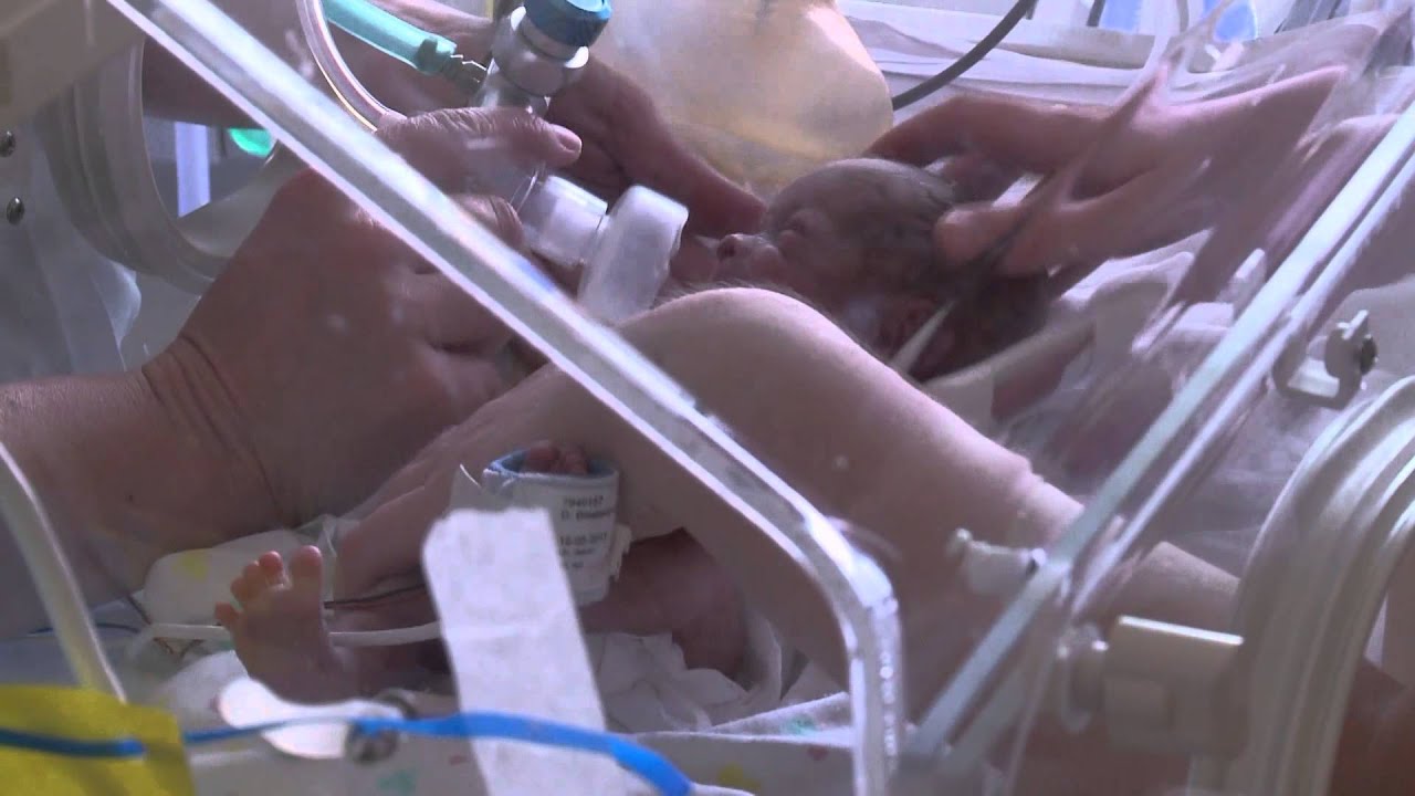 Daniel mag proberen zelf te ademen | Kleine baby's, grote zorg