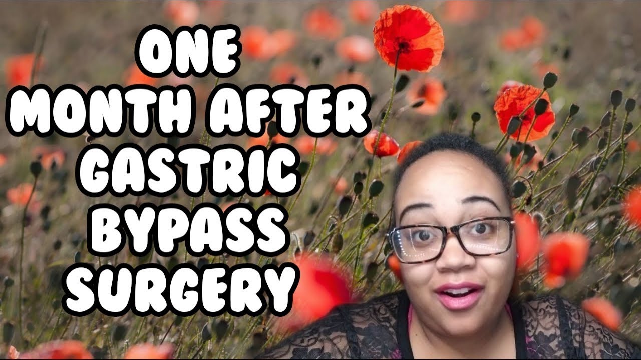 1 Month After Gastric Bypass Surgery