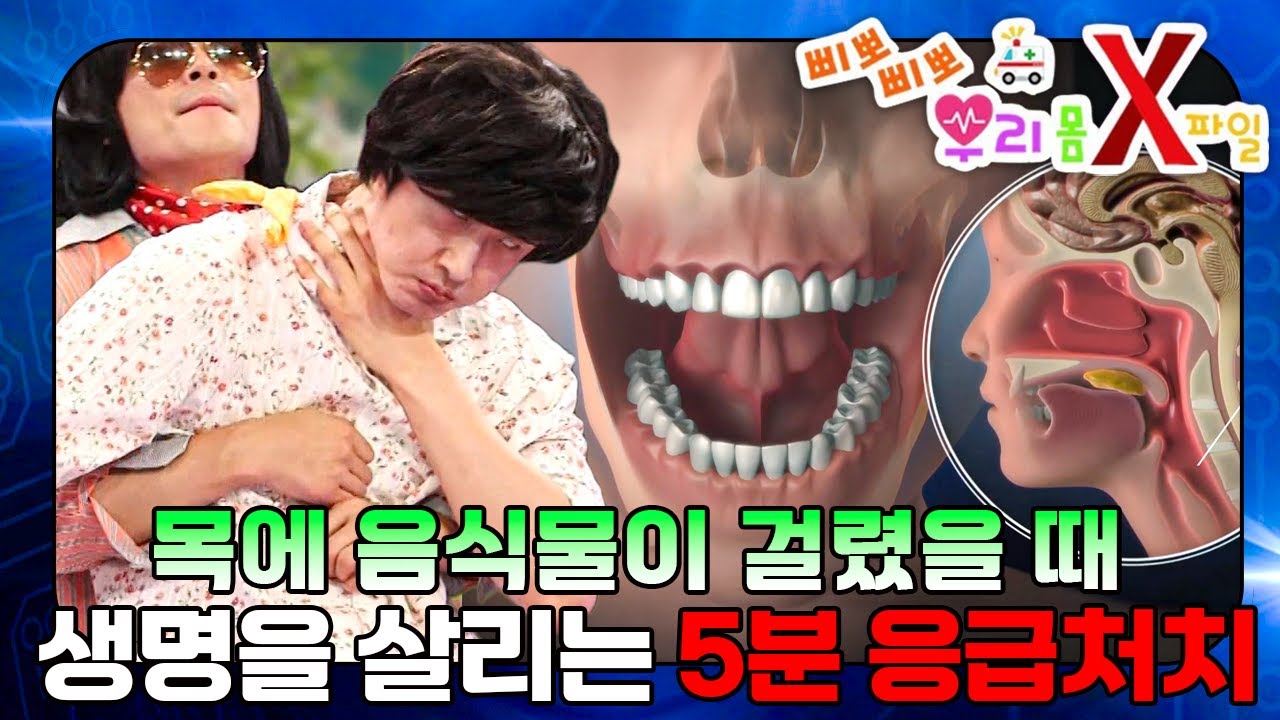 부모님 필수 시청! 떡, 사탕 목에 걸렸을 때 당황하지 않고 대처하는 법｜우리 몸 X파일｜[EBS놀이터]