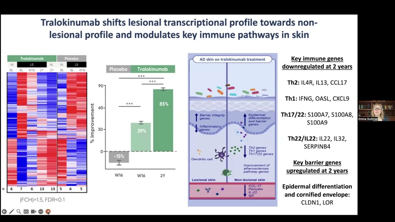 Dr. Guttman Targeting IL-13 with Tralokinumab Normalizes Type 2 Inflammation in AD