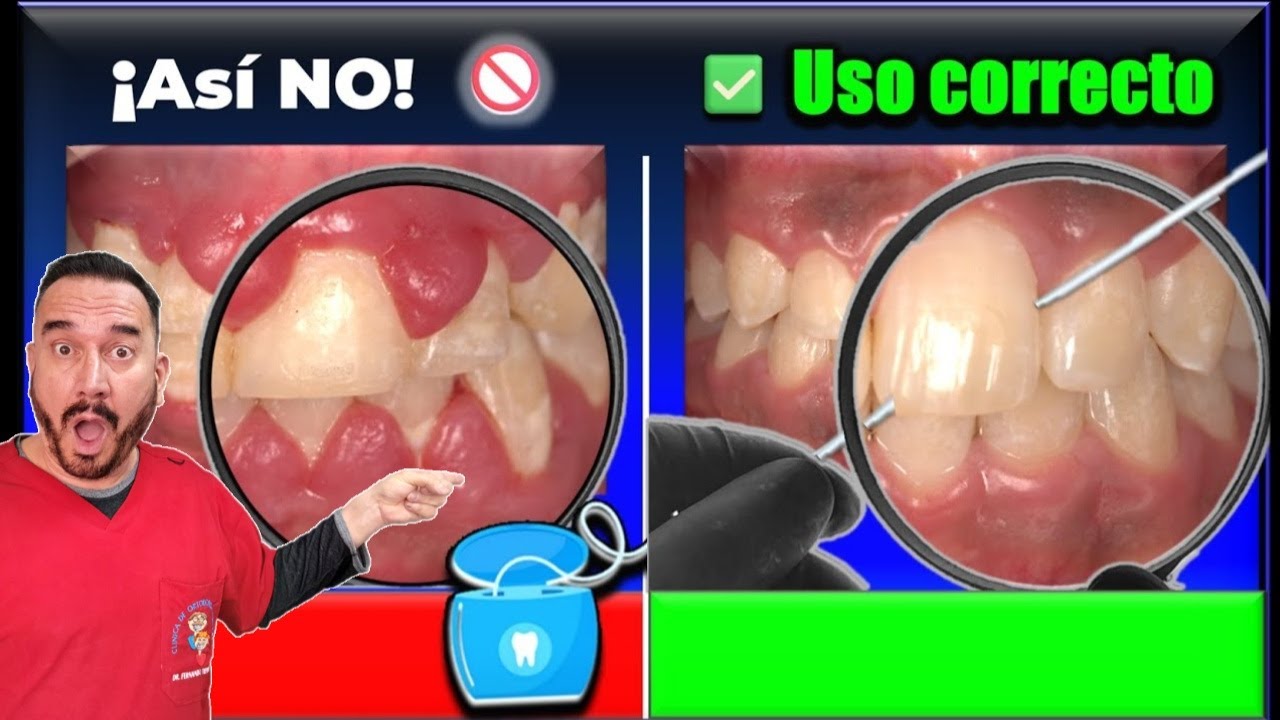 ¿Por Qué Debes Usar Hilo Dental Todos Los Días?