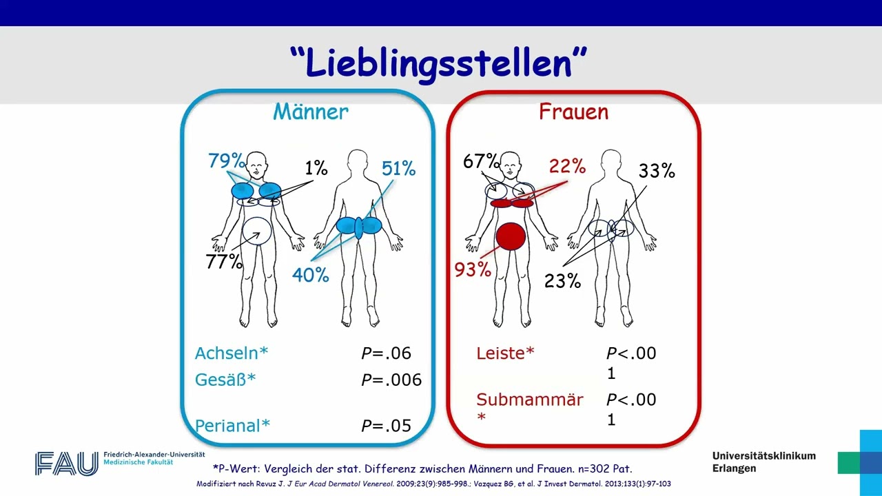 DZI: Chronisch-entzündliche Hauterkrankung Hidradenitis suppurativa (Akne inversa), 29.10.2025