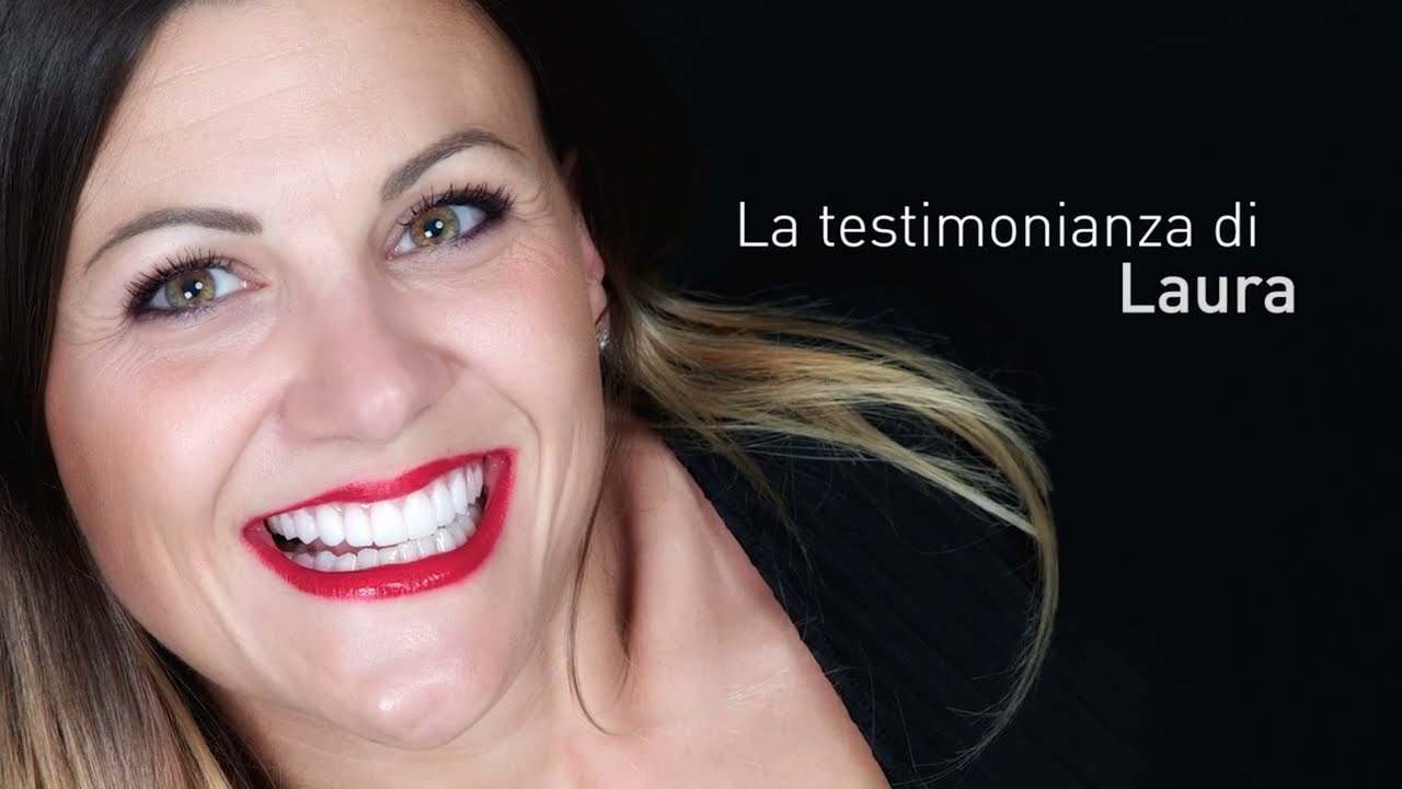Prima e dopo: FACCETTE DENTALI - L'esperienza di Laura