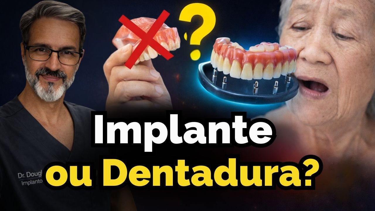 Implante Protocolo: Tudo o Que Você Precisa Saber Antes de Começar