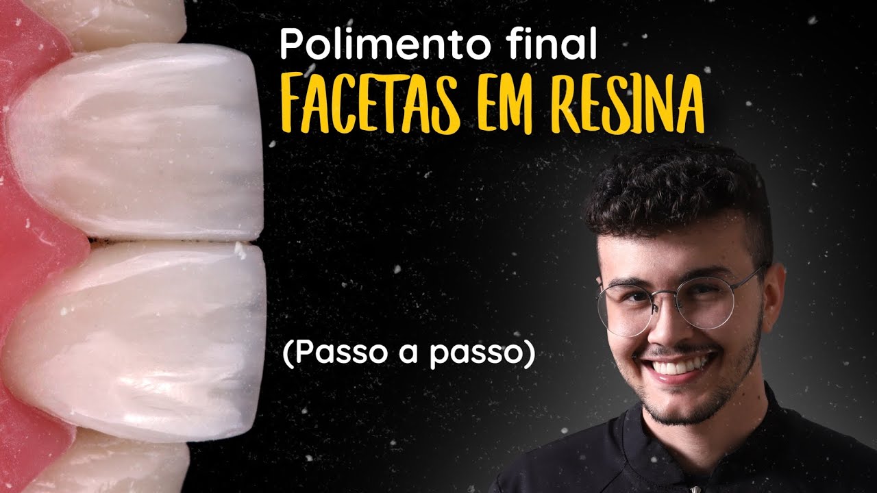 Acabamento a polimento de resinas compostas part #3