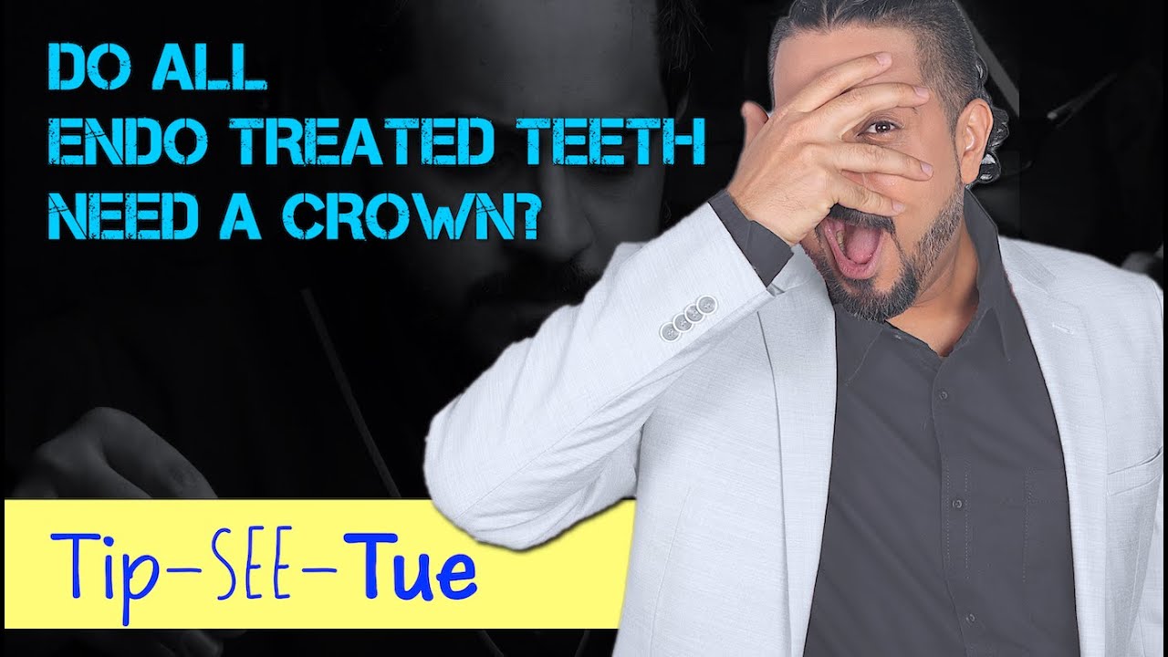 Do All Endo Treated Teeth Need A Crown #learningwithmik