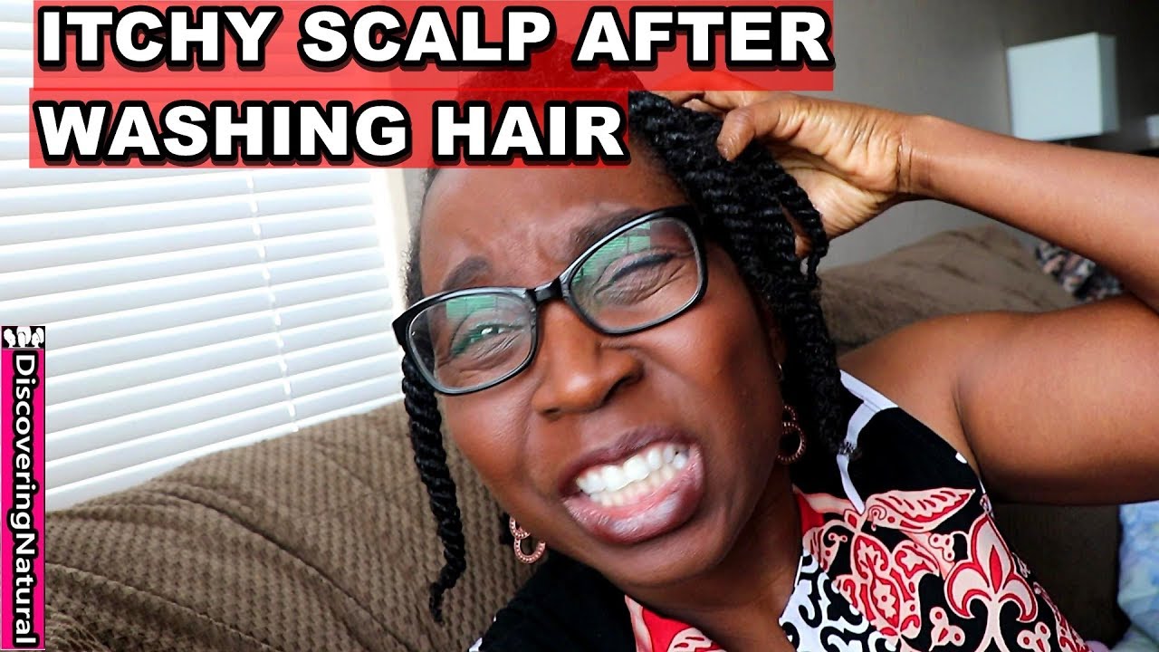 Itchy Scalp After Washing Natural Hair
