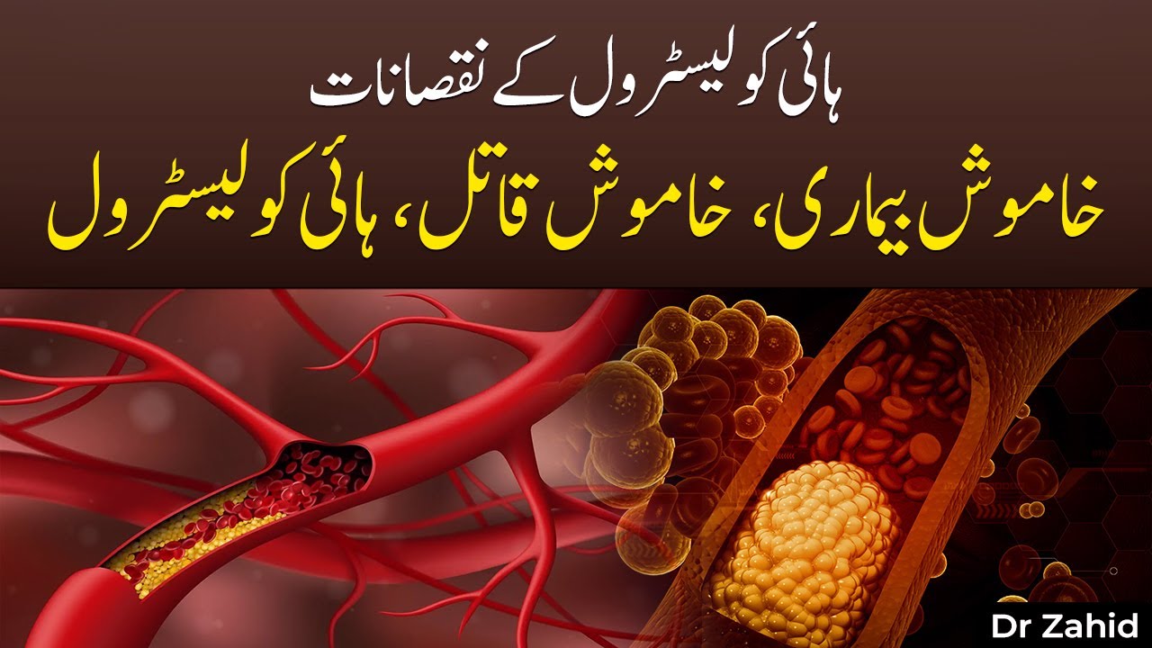 High Cholesterol Se Dil Ko Khatra | Asal Wajuhat Aur Ilaj