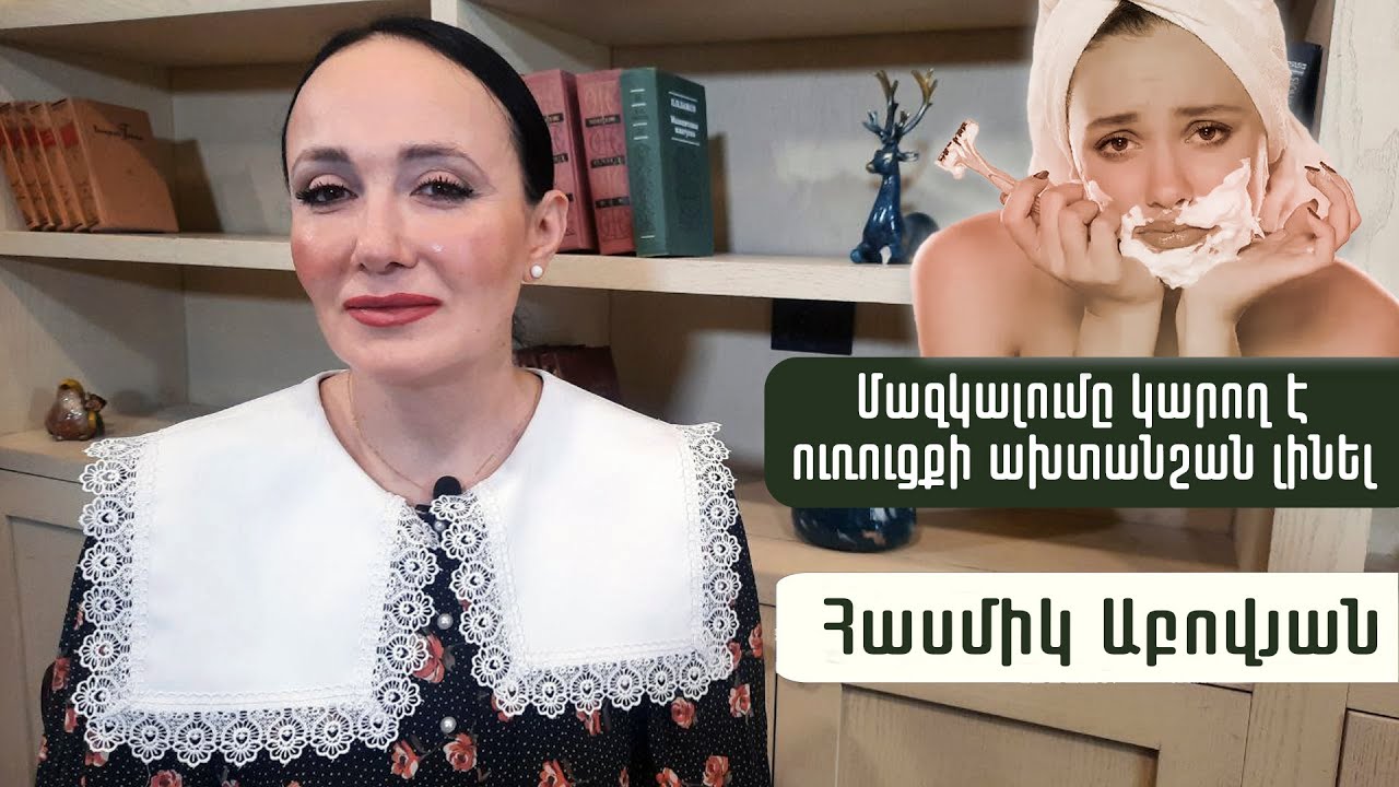 Որո՞նք են մազակալման պատճառները. հիվանդության նշա՞ն, թե՞ ազգային առանձնահատկություն. Հասմիկ Աբովյան
