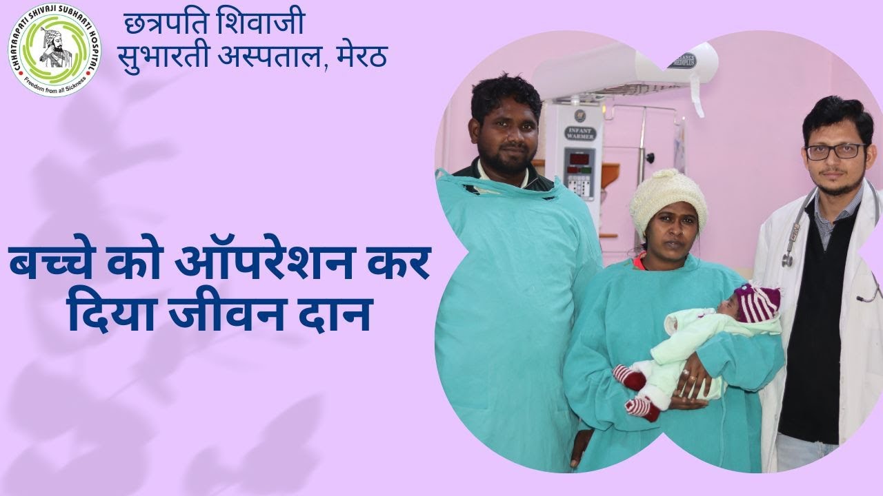 बच्चे को ऑपरेशन कर दिया जीवन दान Subharti hospital