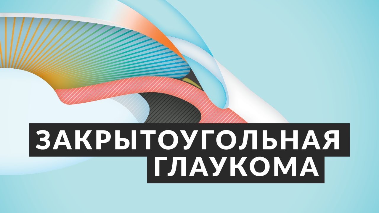 👁️ ОТ ЭТОГО МОЖНО ОСЛЕПНУТЬ! 👁️ Закрытоугольная глаукома: симптомы, причины, лечение Доктор Лапочкин
