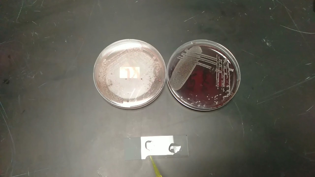 KOH String Test