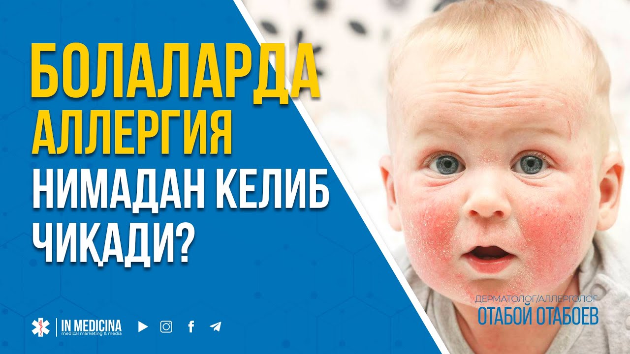 Болаларда Аллергия Нимадан Келиб Чиқади?  #inmedicina  #toshmalar #alergia