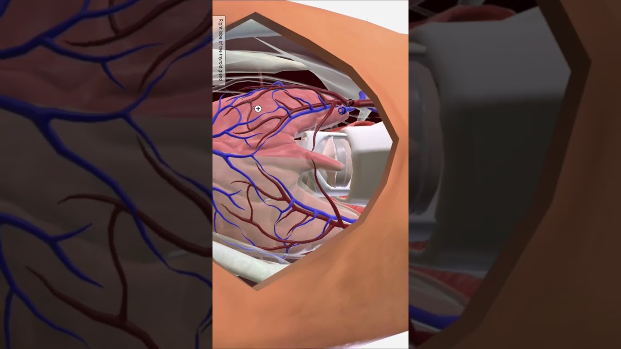 Total Thyroidectomy 3D Animation,Thyroid Surgery Explained,Thyroid Removal Procedure in 60 S