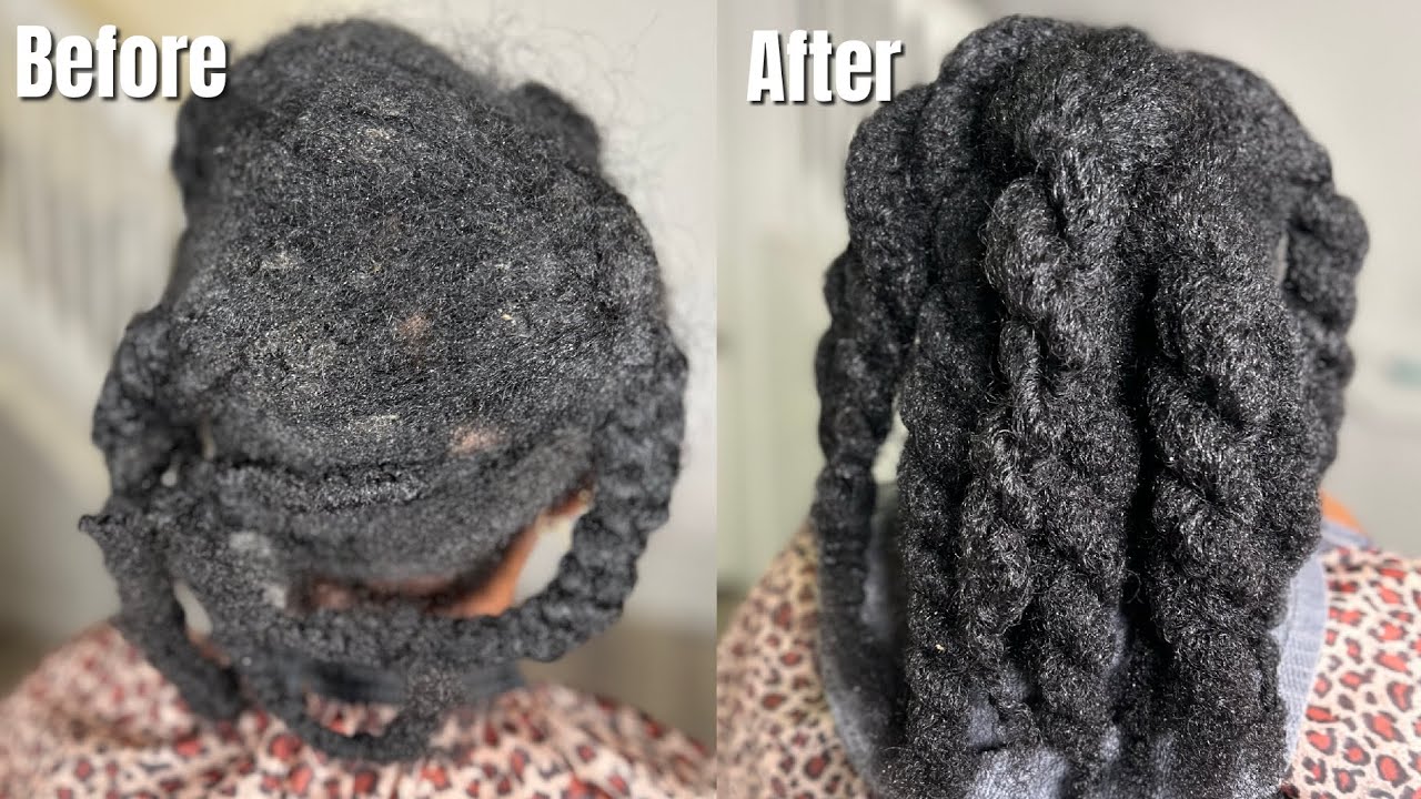 MATTED for MONTHS😨 | How to safely Detangle Natural matted hair| part 2