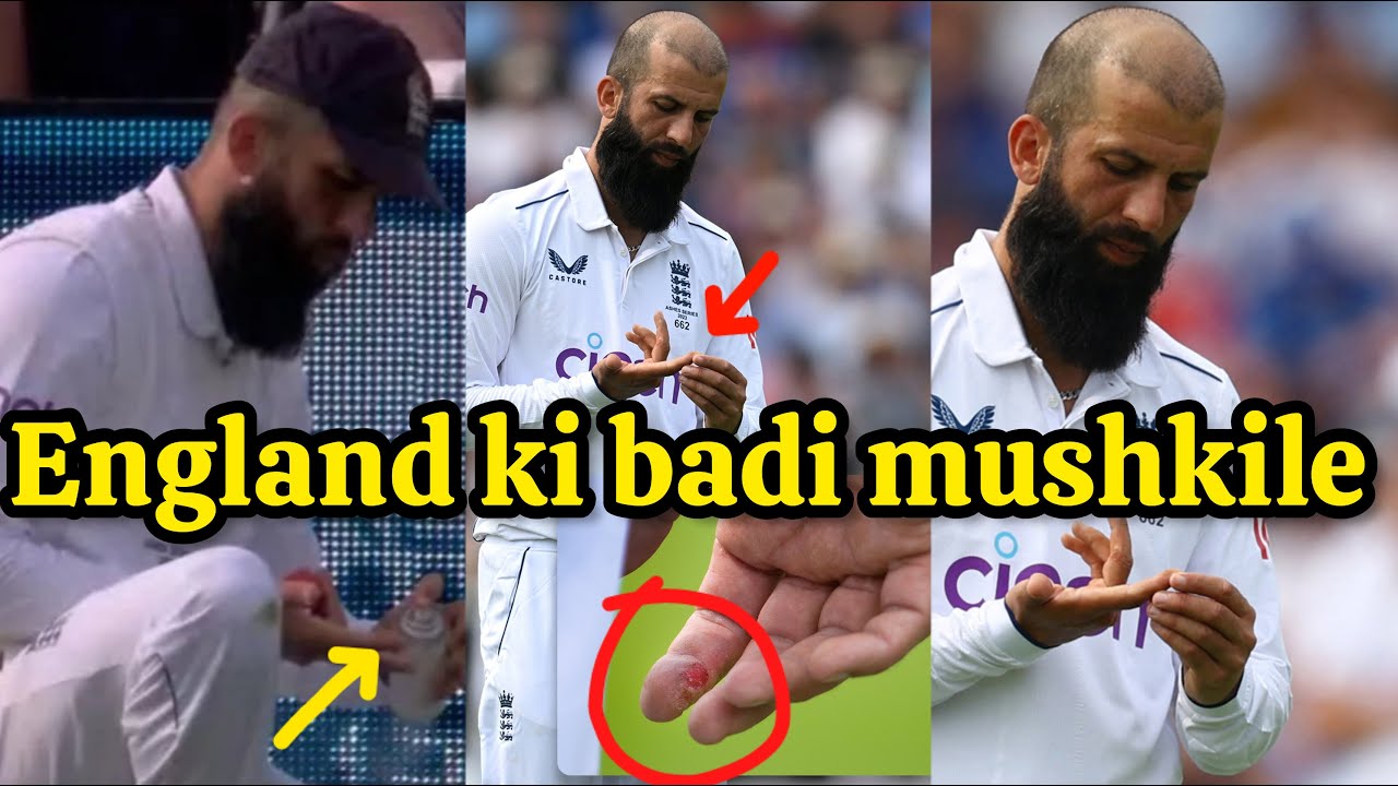 Moeen ali fingur injury during England vs Australia test match series 2023/ ENG vs AUS test match
