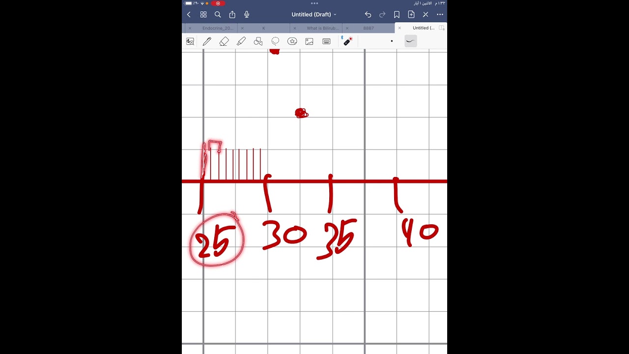 الفيزياء الطبية عملي / شرح رسم تجربة بويل بشكل مُفصل ودقيق / تقنيات التخدير