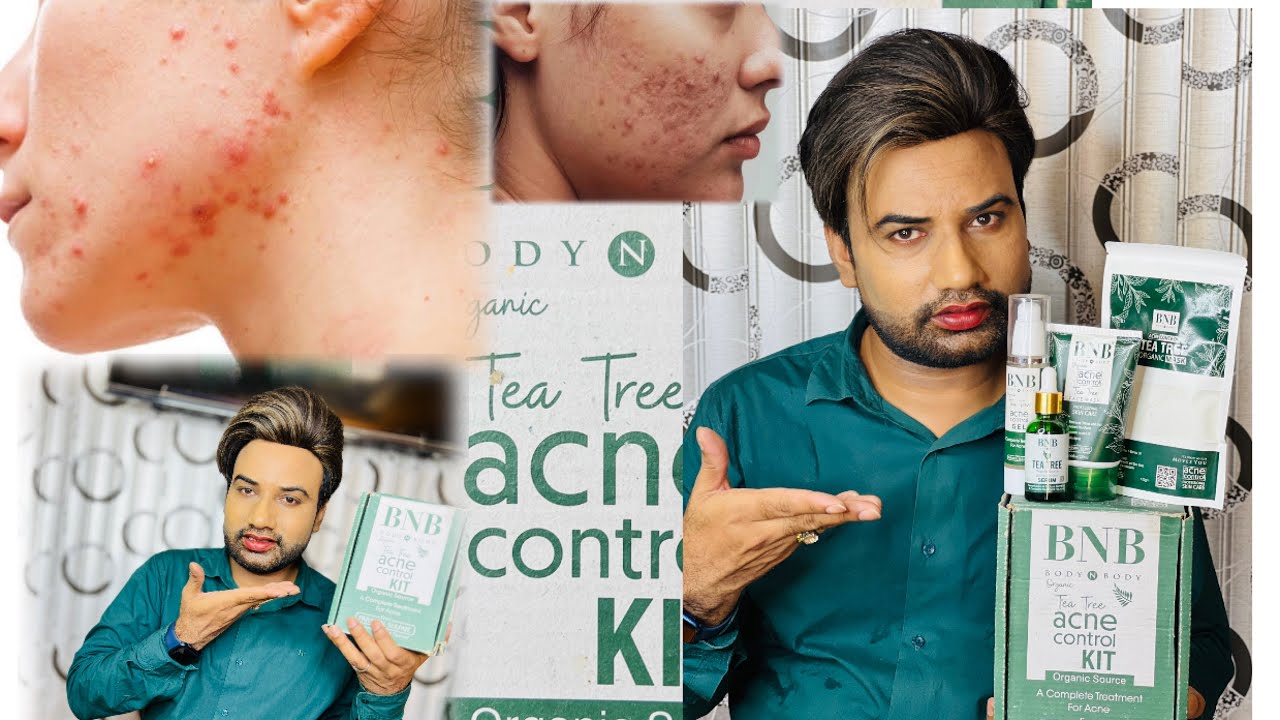 BNB Acne Control Tea Tree kit Honest Reviews // body and body acne control kit. How to use