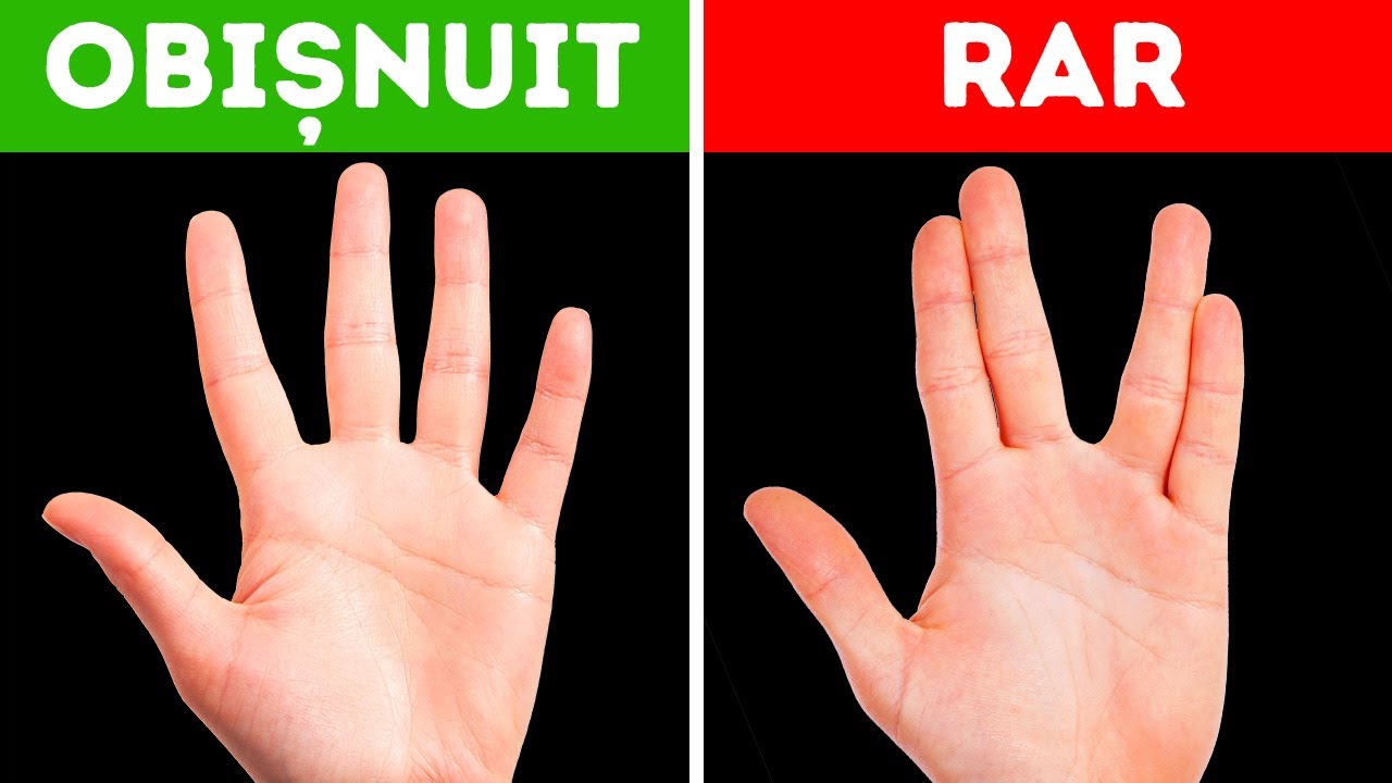 Dacă corpul tău poate face asta, atunci ești unul la un milion