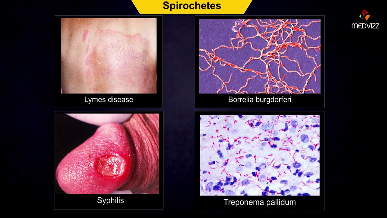 spirochetes microbiology - Animation