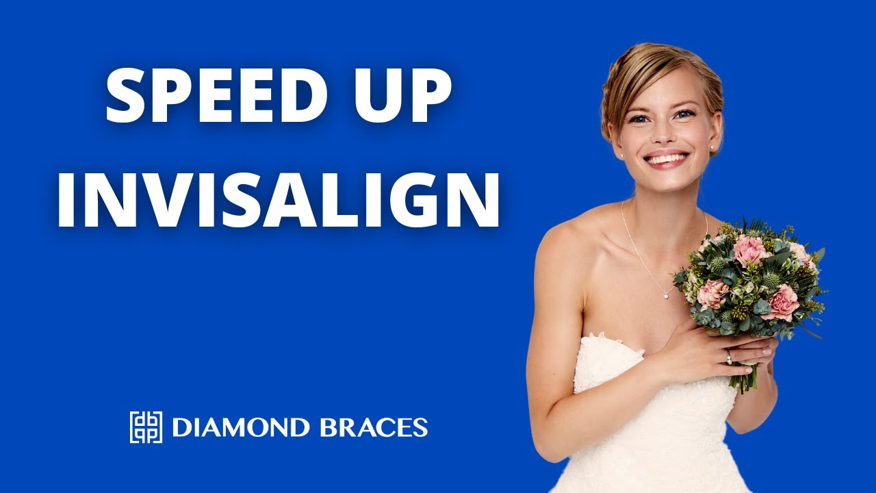 Can You Make Invisalign Treatment Faster?