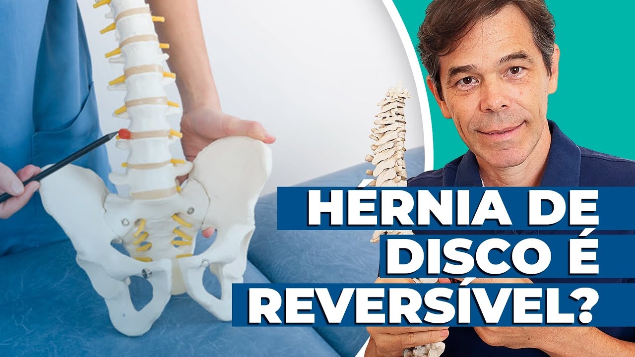 H&eacute;rnia de Disco &eacute; Revers&iacute;vel?