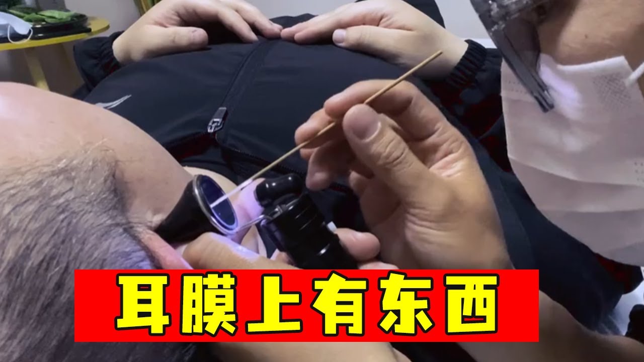 耳朵里面有东西，紧贴耳膜，成功取出
