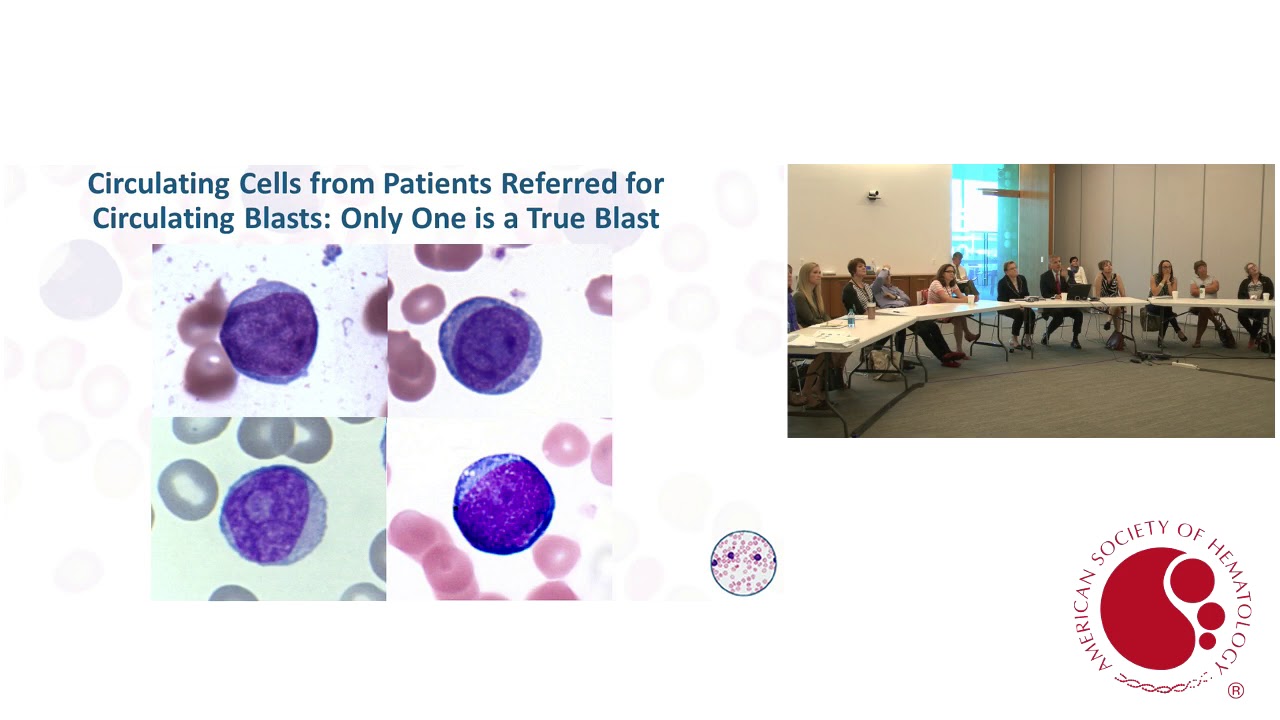Diagnosis: Morphology, Flow Cytometry, Cytogenetics, Molecular Testing, and Risk-Stratification