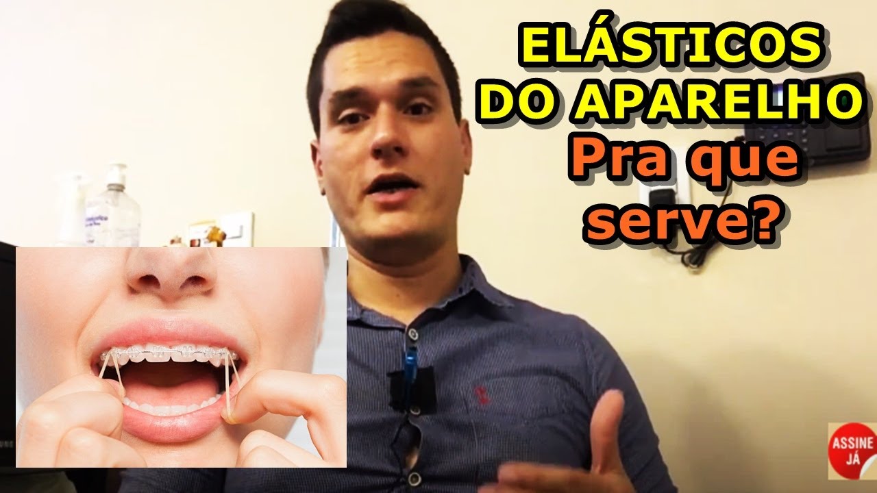 Elástico do aparelho, para que serve?